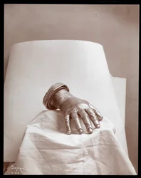 Bronze Cast of the Right Hand of Arthur Rubinstein